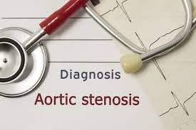 Image for event: Understanding Aortic Stenosis